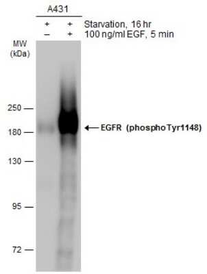 Western Blot: EGFR [p Tyr1148] Antibody [NBP3-13231]